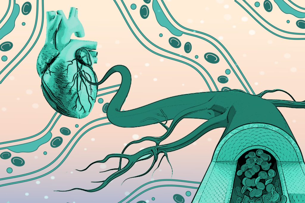 Beyond LDL: Exploring Calcium Scores and CTAs for Better Cardiac Insights