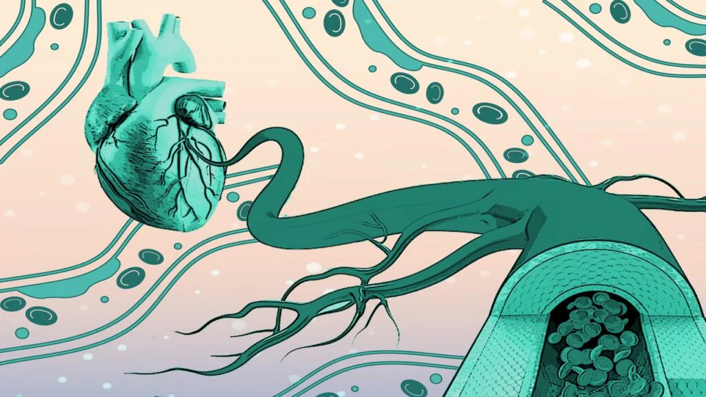 Beyond LDL: Exploring Calcium Scores and CTAs for Better Cardiac Insights
